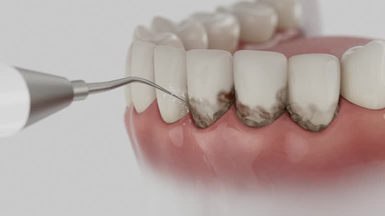 Reliable Dental Implants contractor in Isla Vista, CA by Smile Center Dentistry